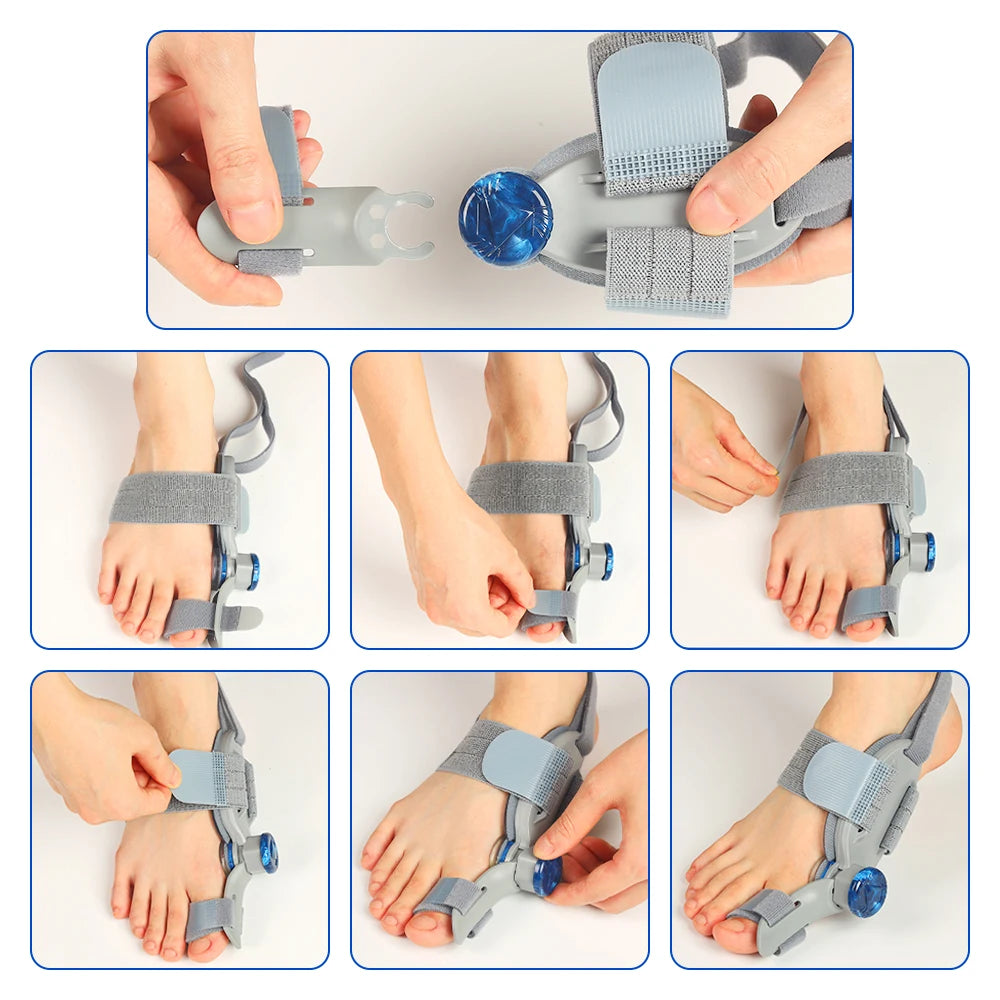 Adjustable Rotatable Toe Orthotic for Women and Men Day Night Left & Right Feet Toe Separator